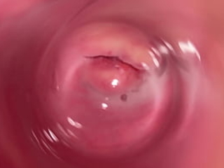 Inward camera inside taut creamy Vagina,